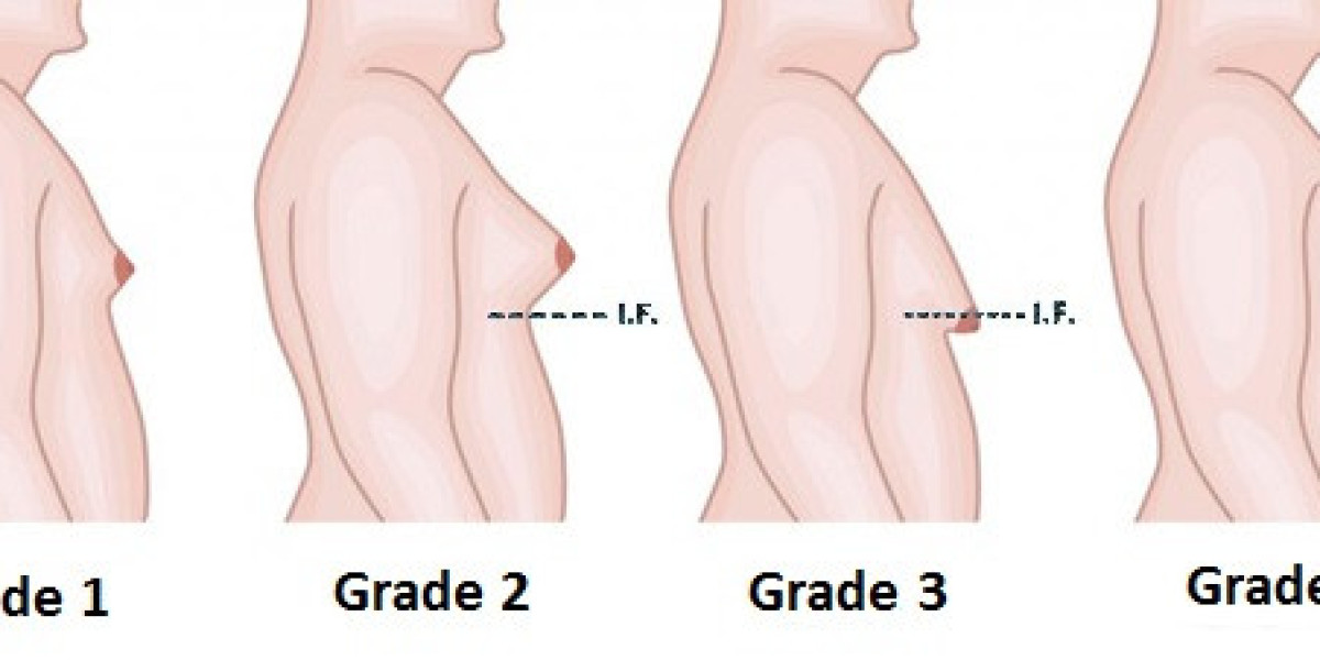 A Comprehensive Guide to Breast Augmentation in Islamabad: Enhancing Confidence and Beauty