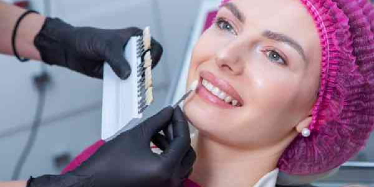 Smart Choices for a Stronger Smile in Havant