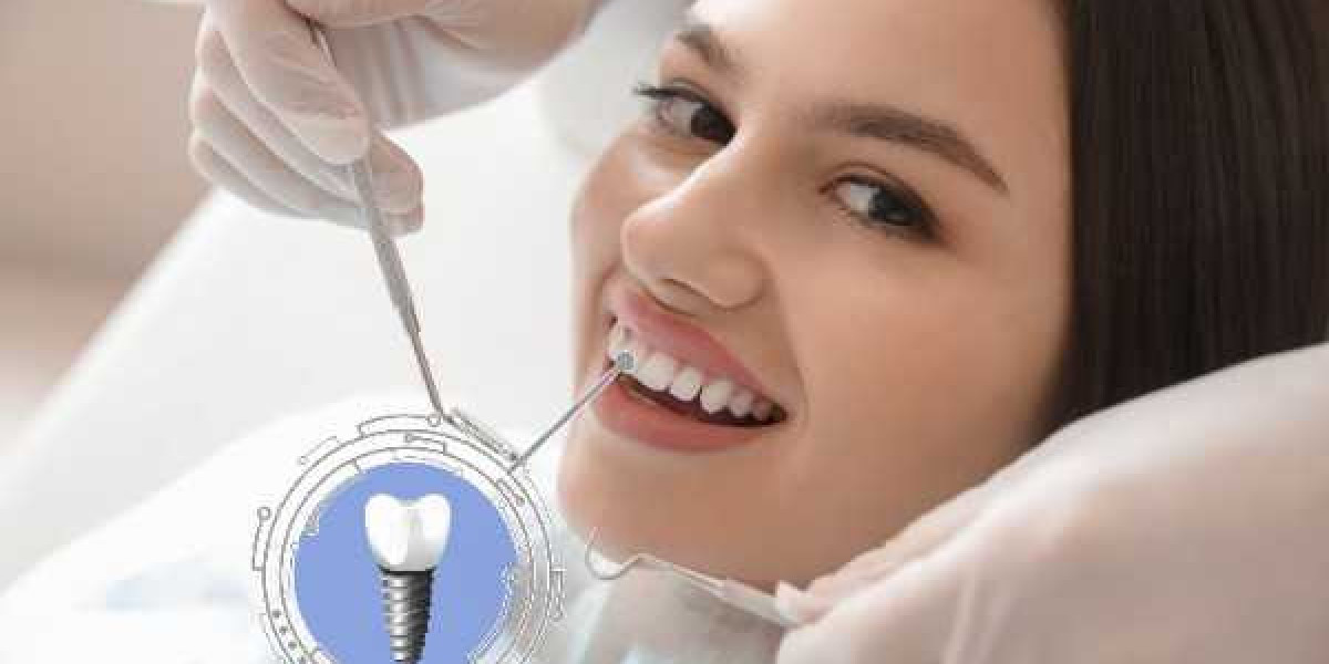 Smart Choices for a Stronger Smile in Havant