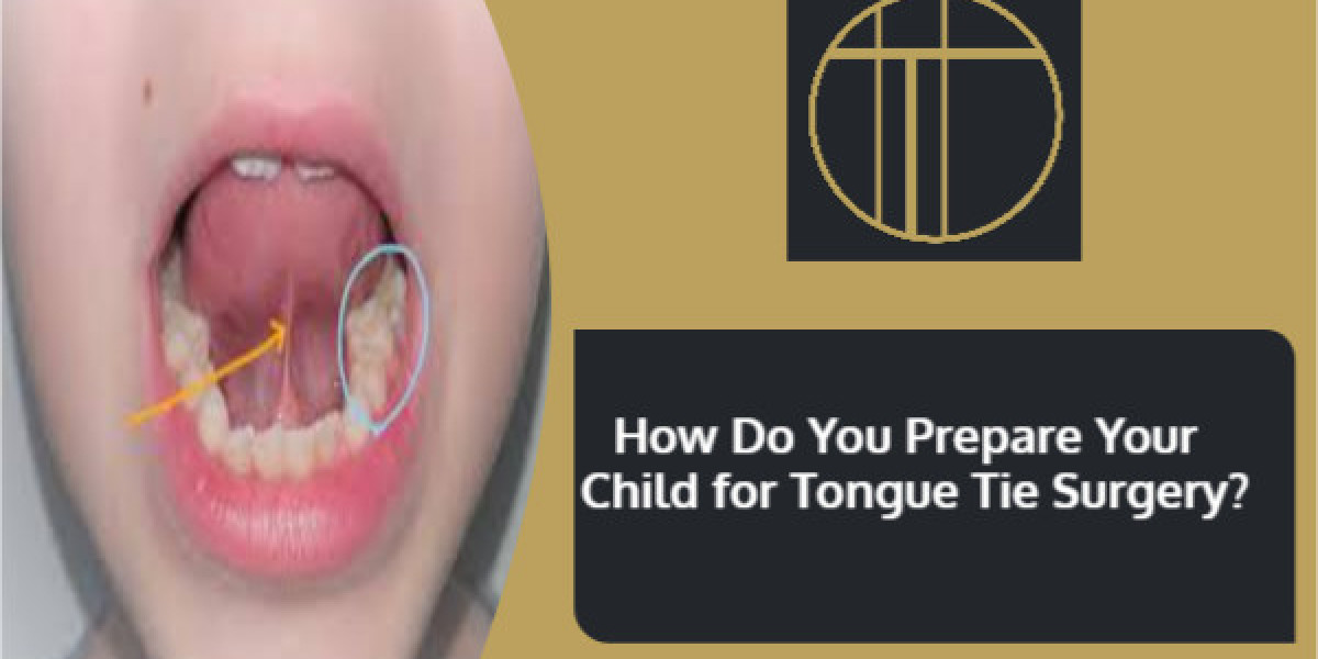 How Do You Prepare Your Child for Tongue Tie Surgery?