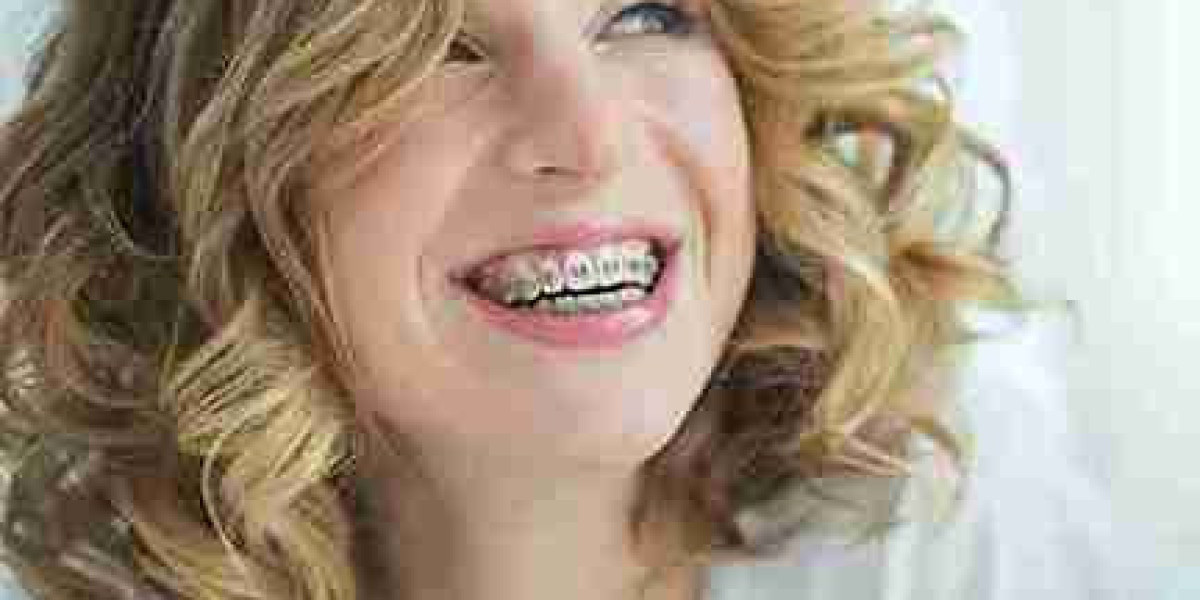 The Clean Finish Your Smile Has Been Missing in a Taunton