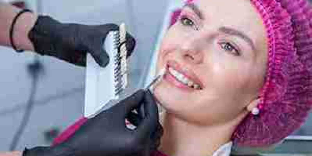 Top 10 Tips to Keep Your Teeth Whiter for Longer