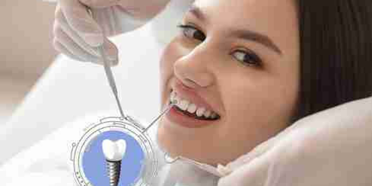 Dental Implants Designed for Every Age and Emergency