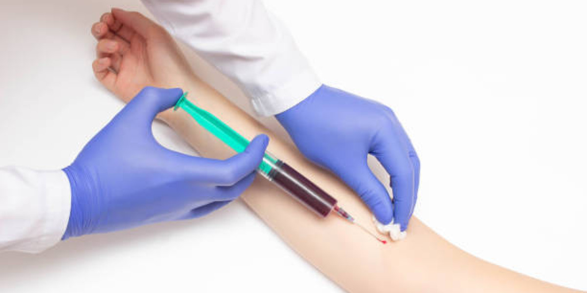 What Are the Different Types of Mycoplasma Tests?