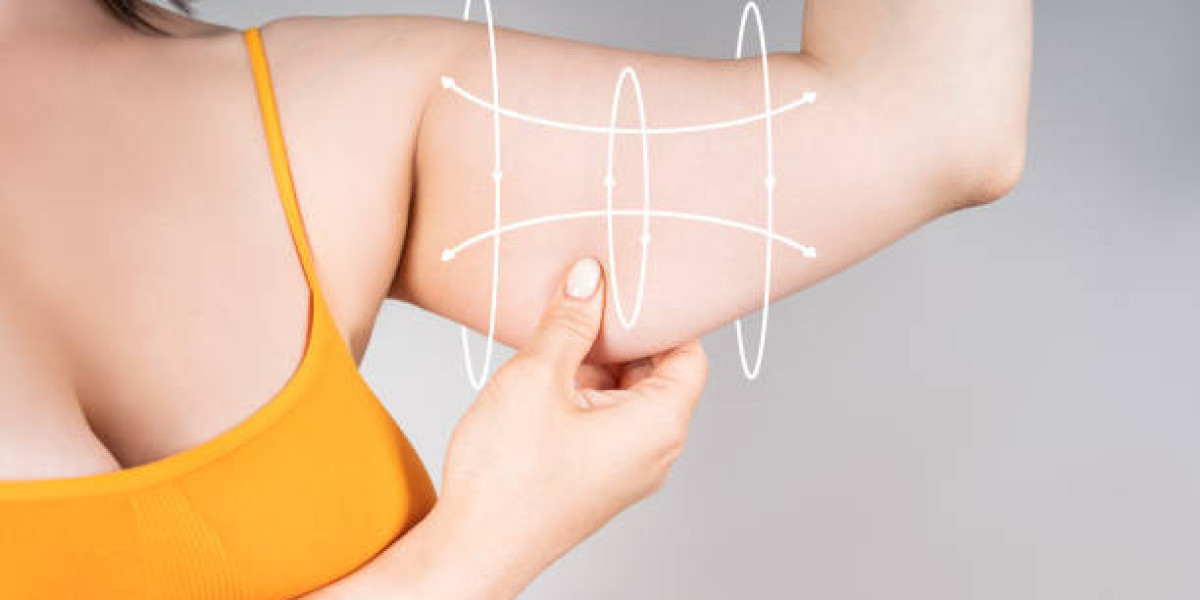Arm Lift Surgery in Dubai for Better Proportions