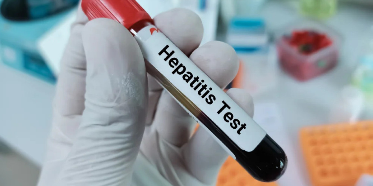 How Often Should Hepatitis B Testing Be Done?