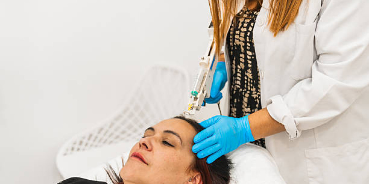 فوائد العلاج بالبلازما الغنية بالصفيحات الدموية للبشرة والشعر