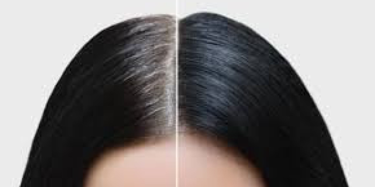 How Long Should I Wait Between White Hair Removal Sessions?