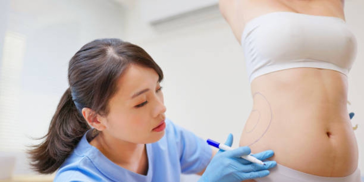 Liposuction Procedure Aftercare: Foam Rolling Tips