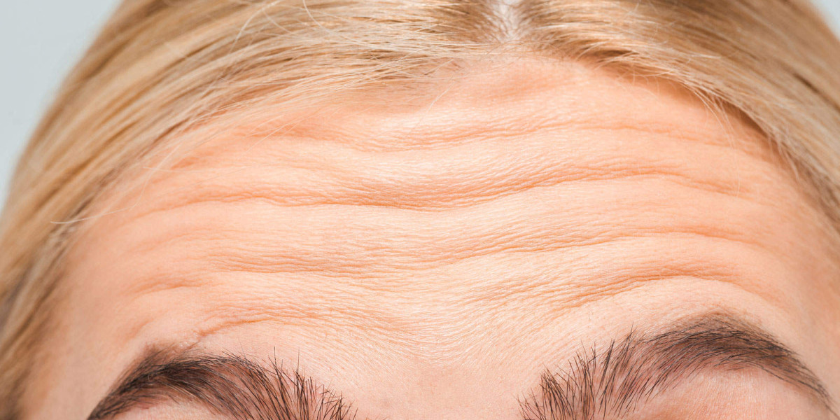 What Lifestyle Habits Cause Wrinkles Faster?
