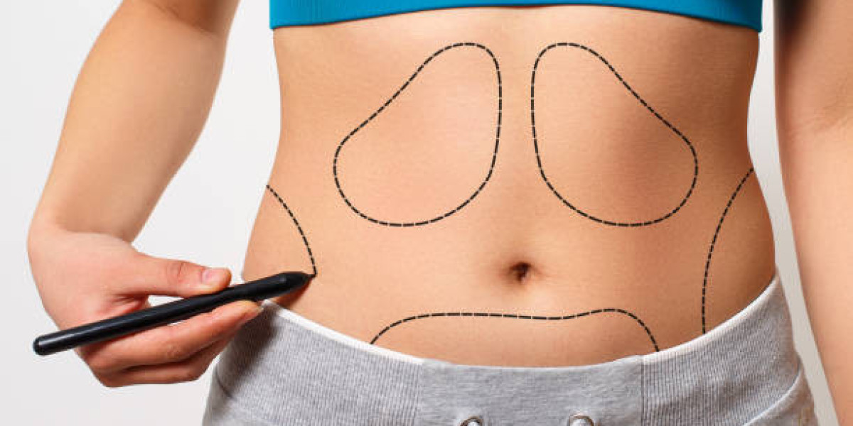 Liposuction Procedure Aftercare: Compression Garments