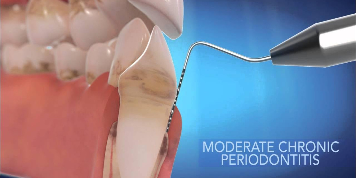 Common Dental Problems We See in Dallas and How to Prevent Them