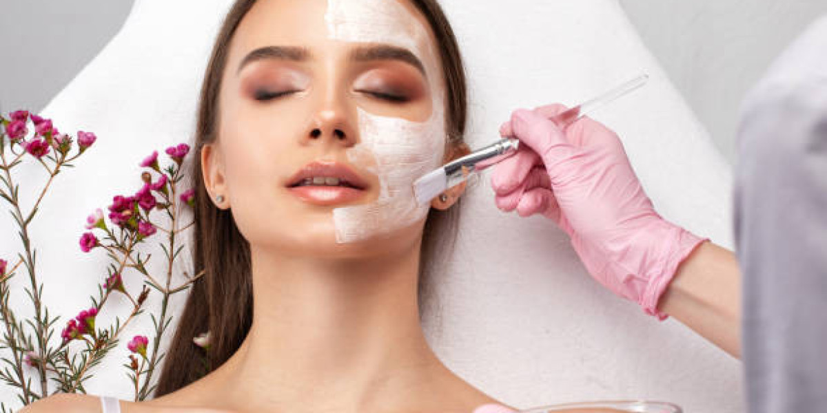 Chemical Peels for Oily Skin: Control and Clarify