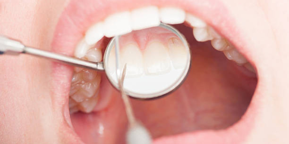 What Determines Your Filling Price