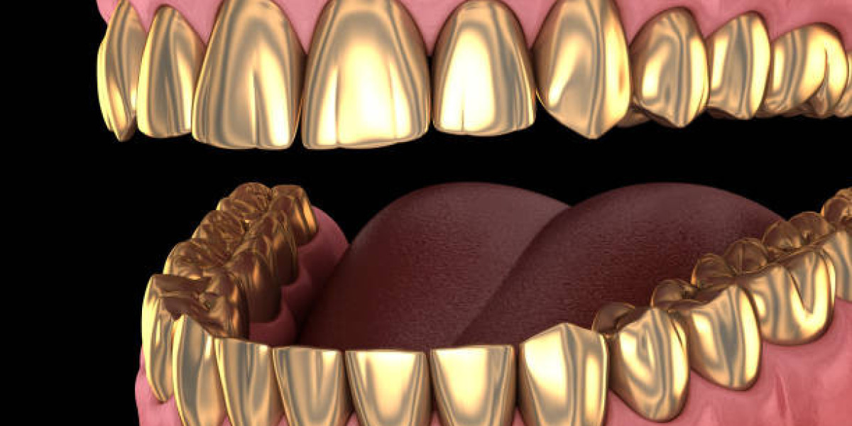 Everyday Care for Gold Teeth Lovers
