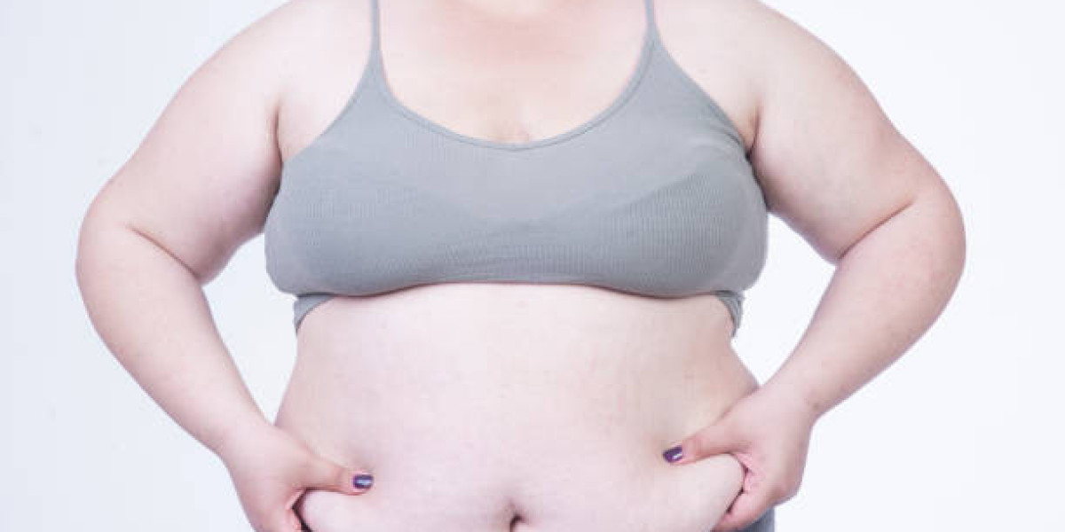 Tummy Tuck Surgery Timeline: From Consultation to Results