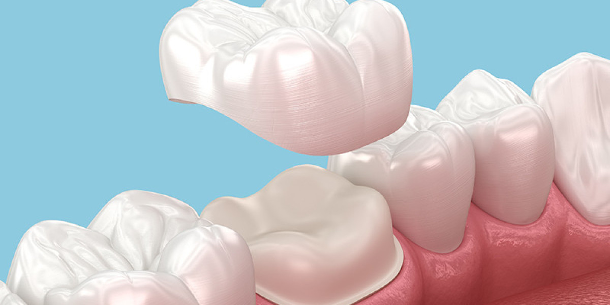 Dental Crowns and Bridges Dubai for Strong, Natural Smiles
