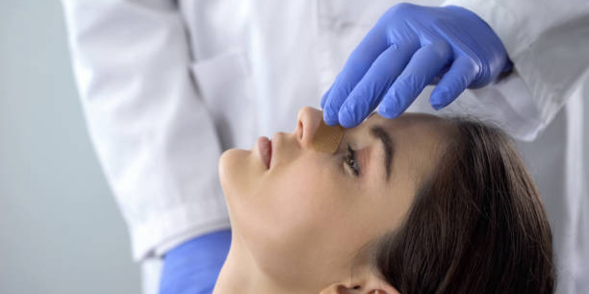 معايير اختيار جراح عملية تجميل الأنف الممتاز